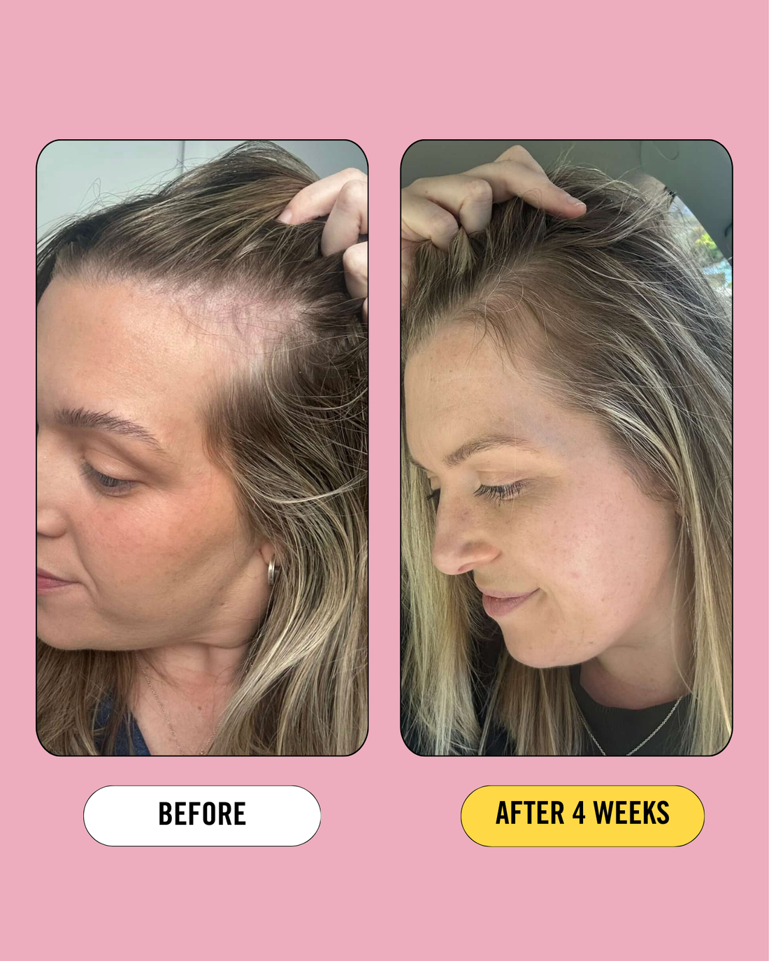Post Pregnancy Prebiotic Treatment 80ml