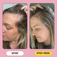 Post Pregnancy Prebiotic Treatment 80ml